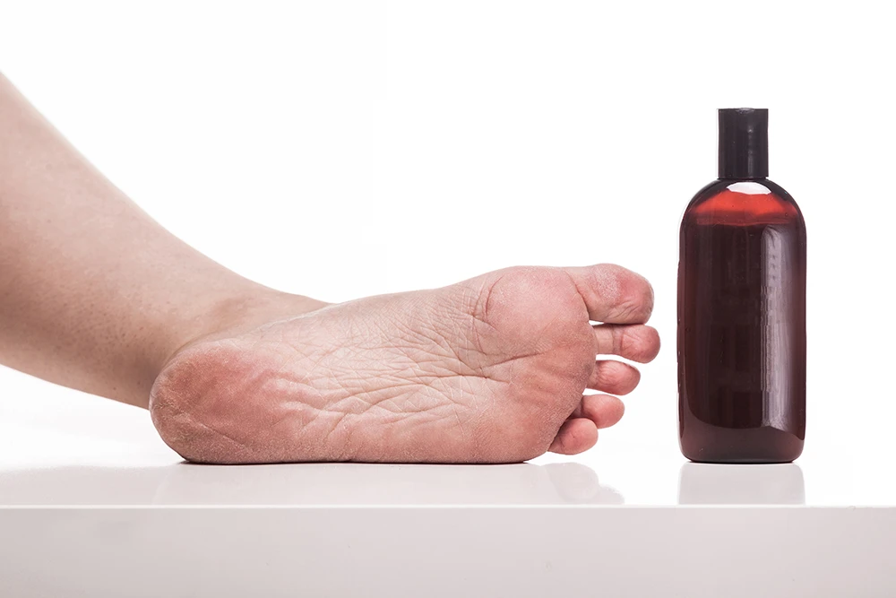 Is Hydrogen Peroxide Safe for Nail Fungus?