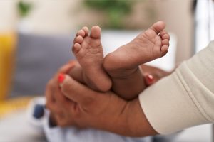 What Are Clubfoot Baby Foot Problems?