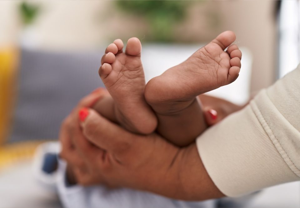 What Are Clubfoot Baby Foot Problems?