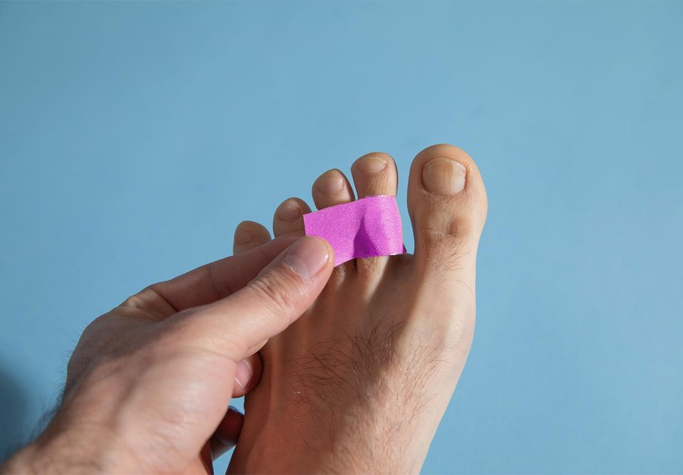 How to Fix Hammer Toes with Tape?