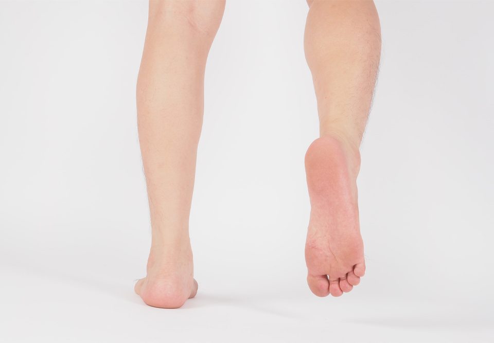 Running with Flat Feet: Is It Possible?