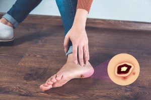 What is the Best Dressing for Diabetic Foot Ulcers?