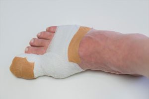 5 Signs of Infection After Toenail Removal Surgery