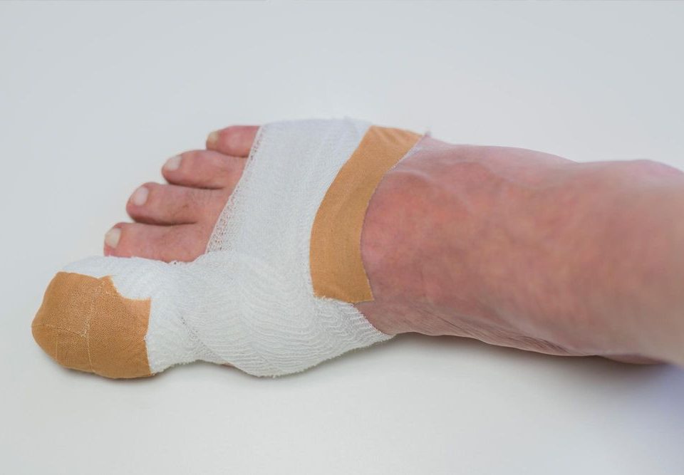 5 Signs of Infection After Toenail Removal Surgery