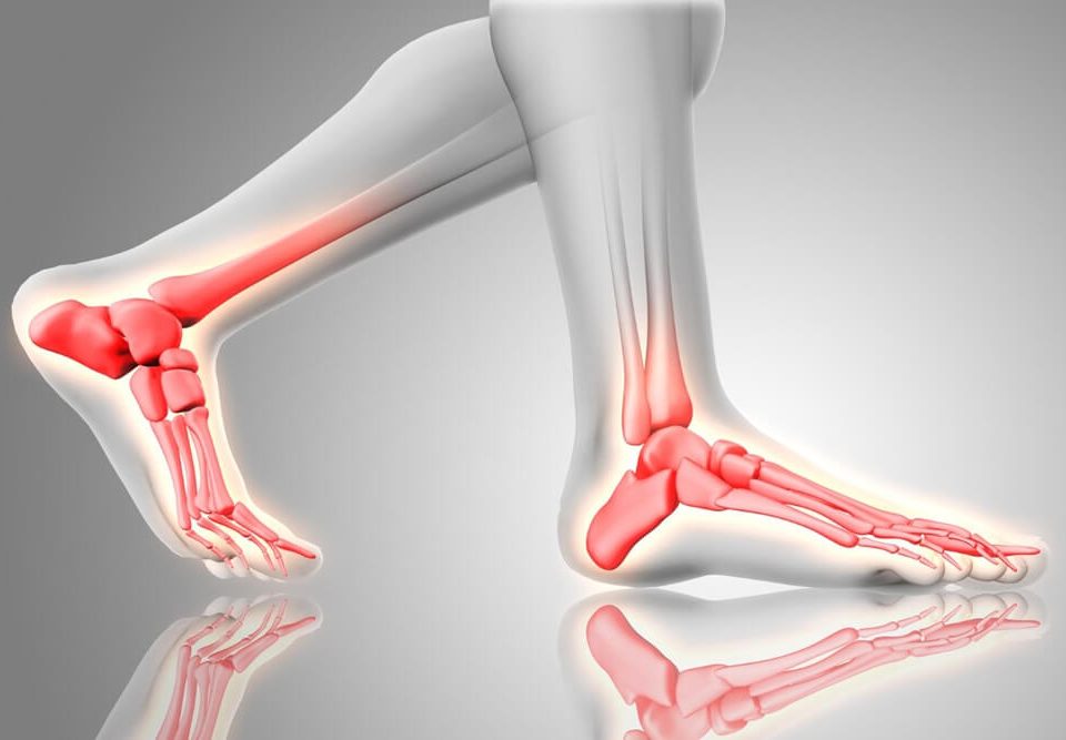 What Are the Causes of Heel Pain in the Morning?