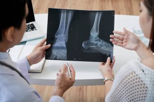 What Are the Different Types of Bunion Surgery?