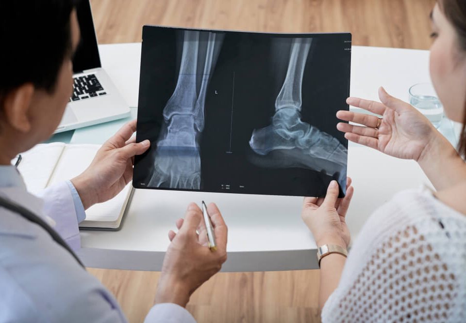 What Are the Different Types of Bunion Surgery?