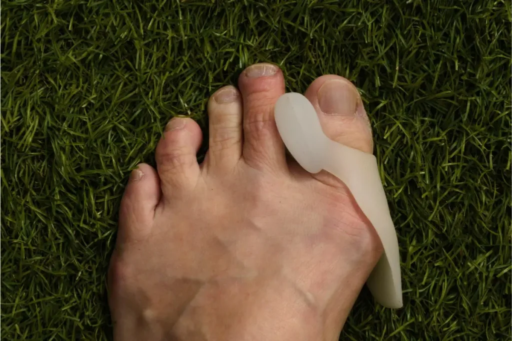 Bunion Treatments in Mesa