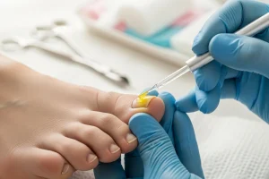 How Dangerous Is a Nail Fungus?