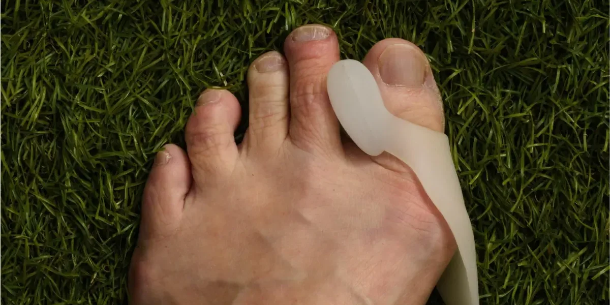 Bunion Treatments in Mesa, AZ Bunion Treatments in Mesa